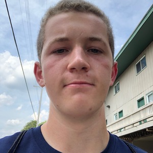 Fundraising Page: Zachary Krieger